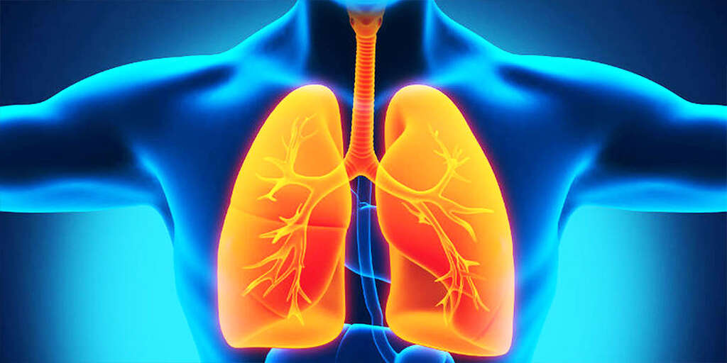 Polymyositis