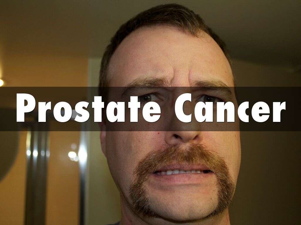 Prostate Cancer