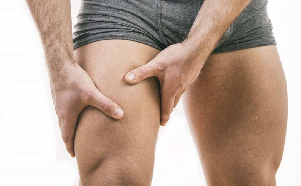Pulled Groin