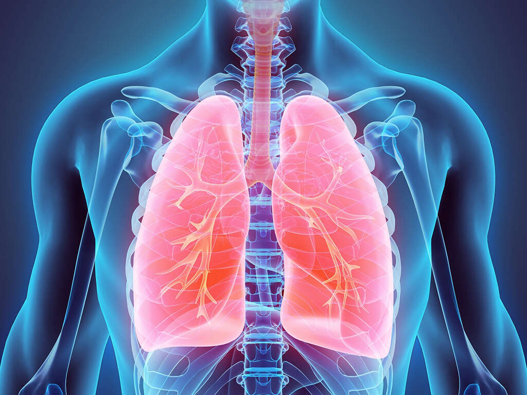 Pulmonary Edema