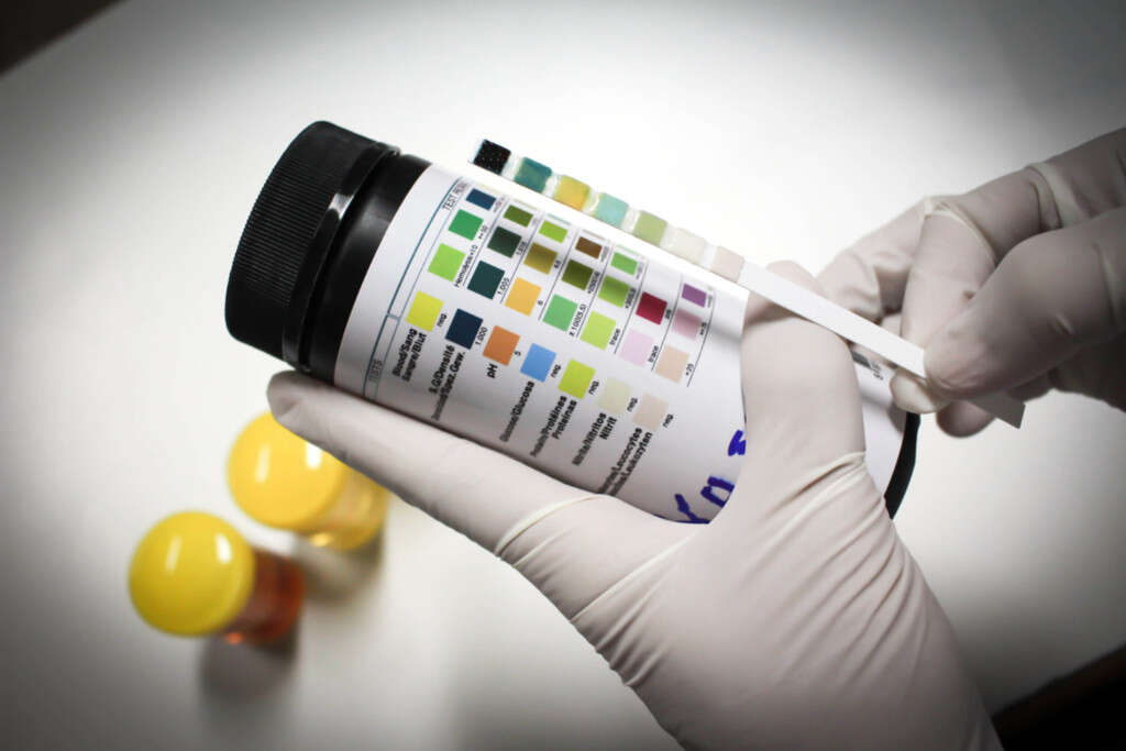 Renal Failure