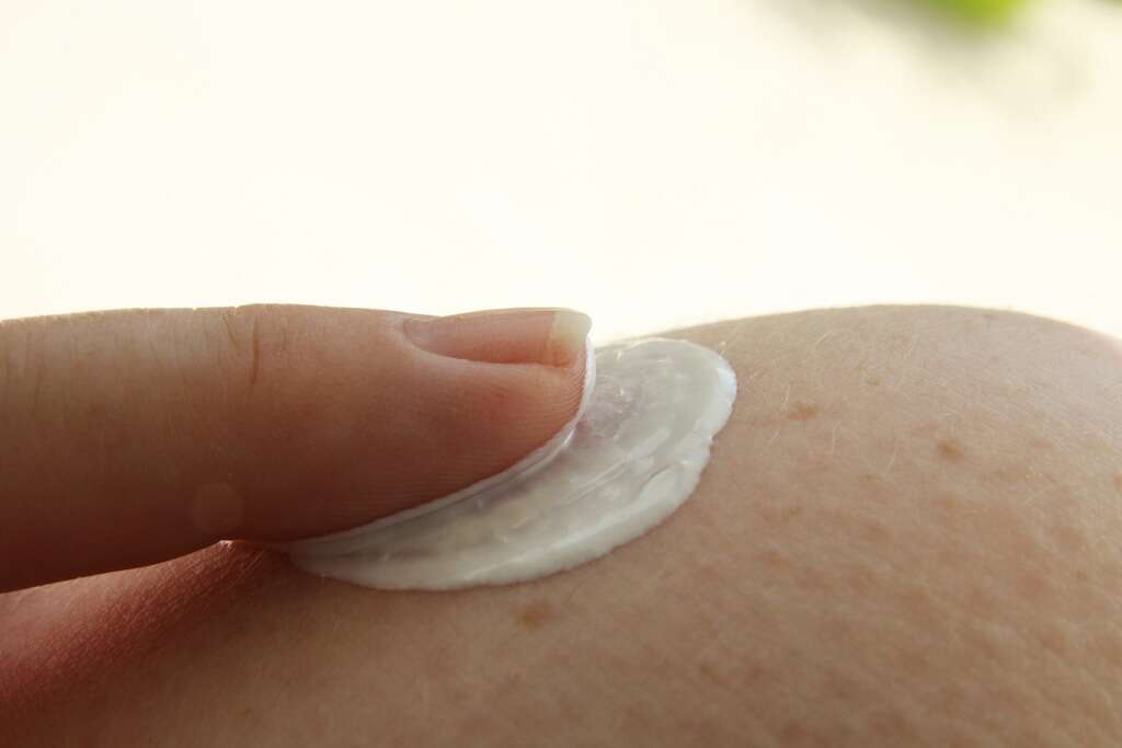 Ringworm