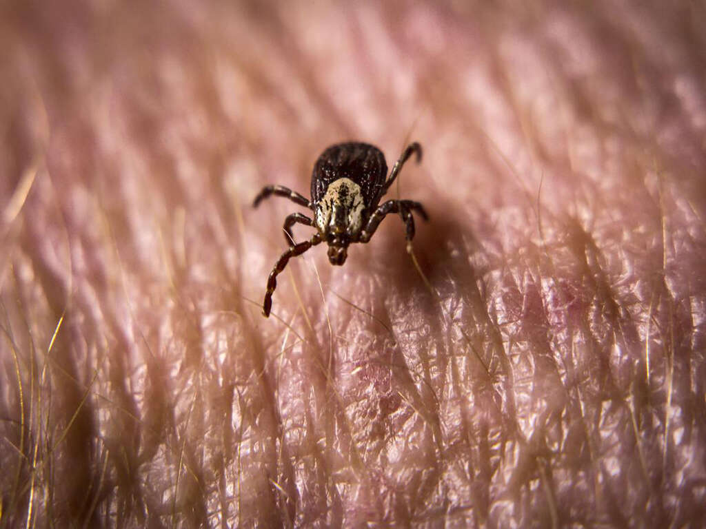 Rocky Mountain Spotted Fever