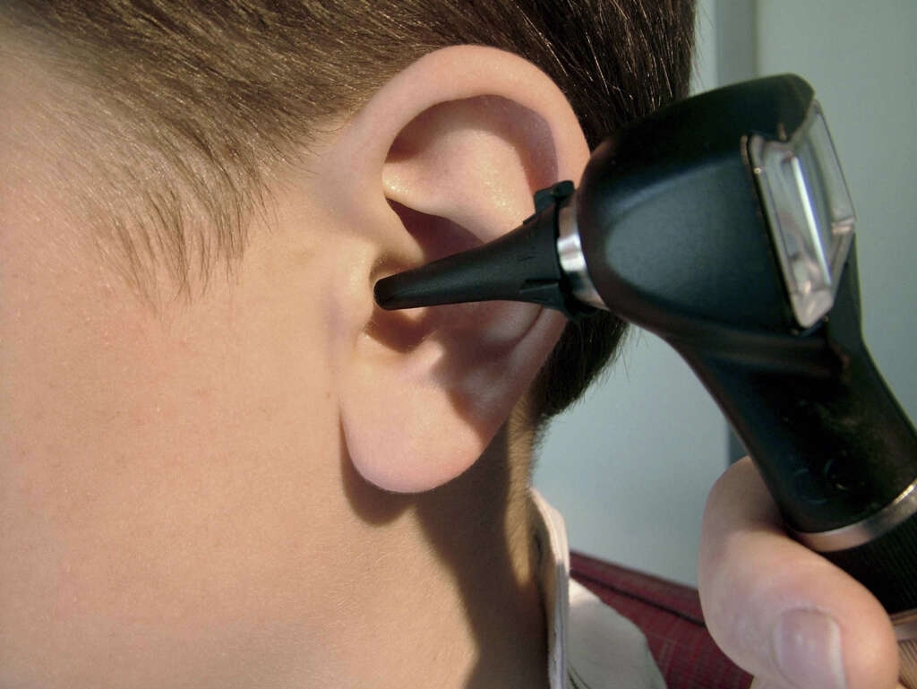Ruptured Eardrum