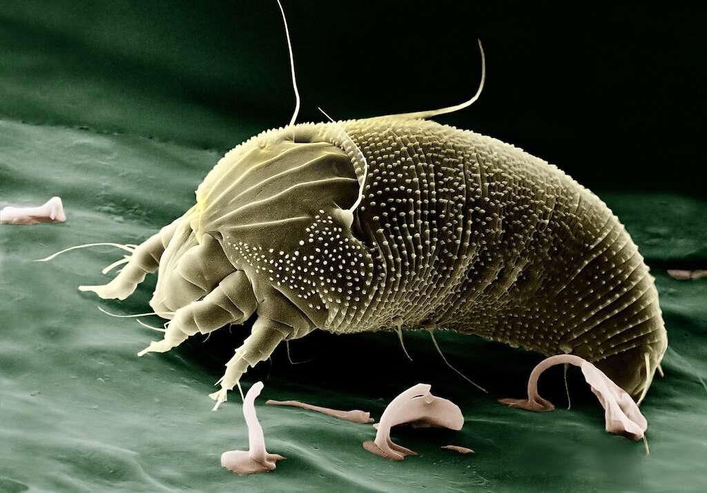 Scabies