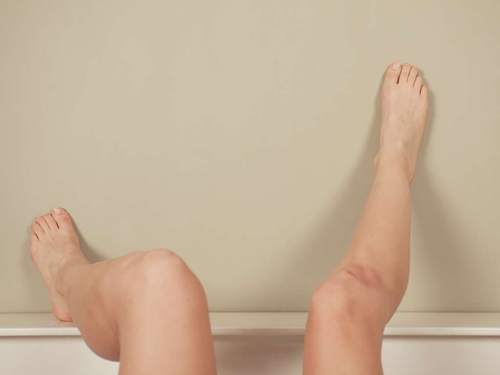 Scleroderma
