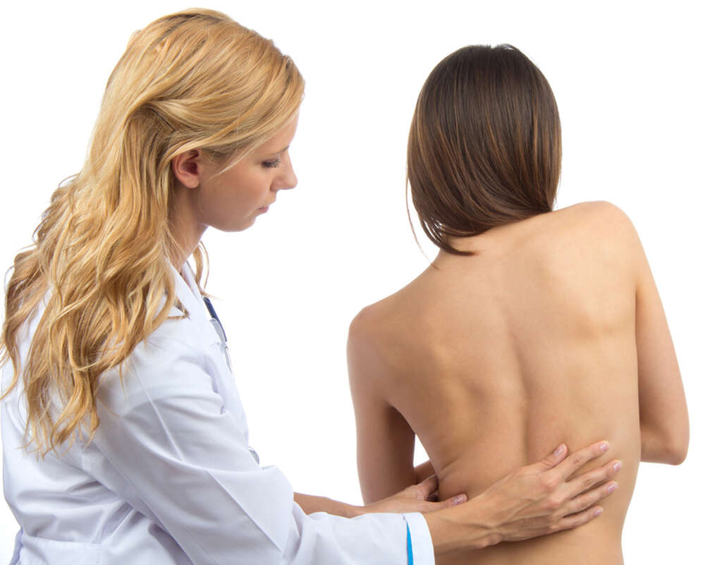 Scoliosis