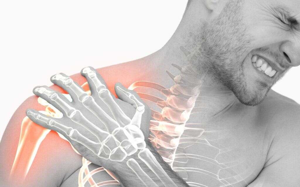 Shoulder Impingement