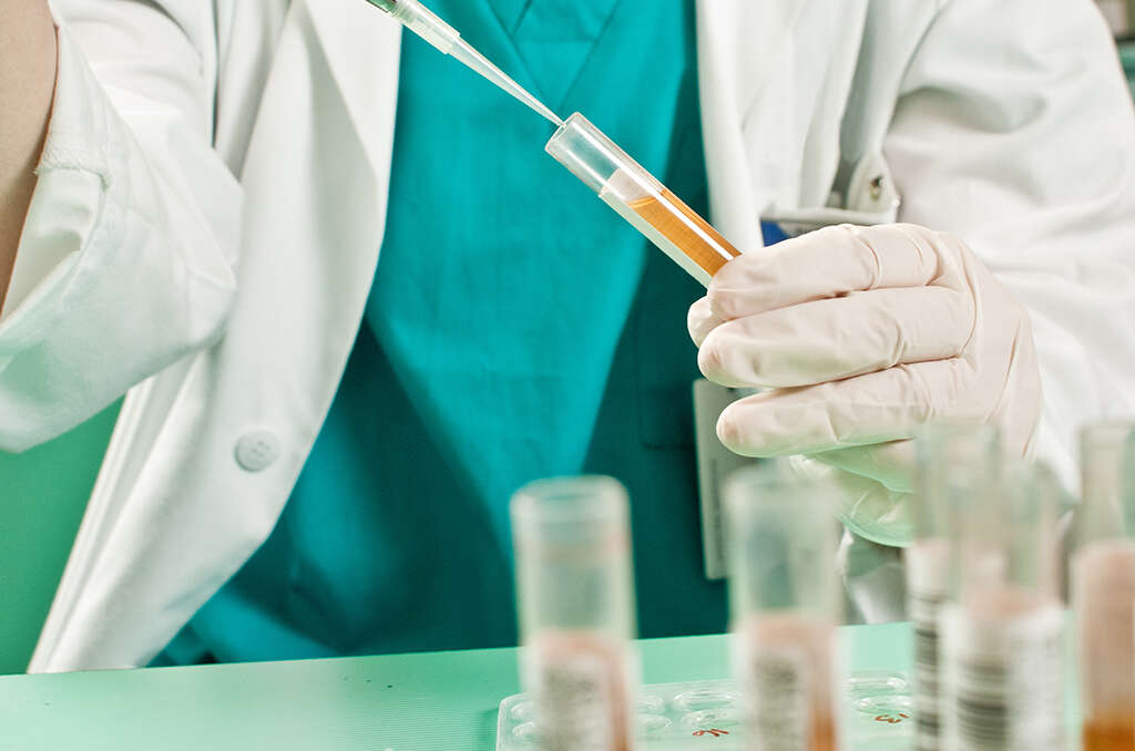 Cervical Cancer