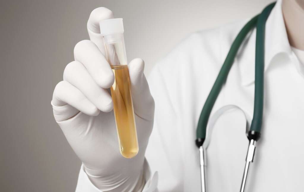Endometriosis