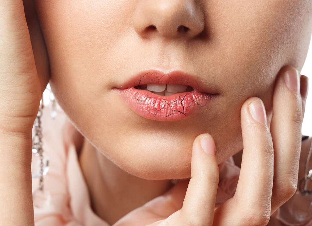 Sjogren's Syndrome