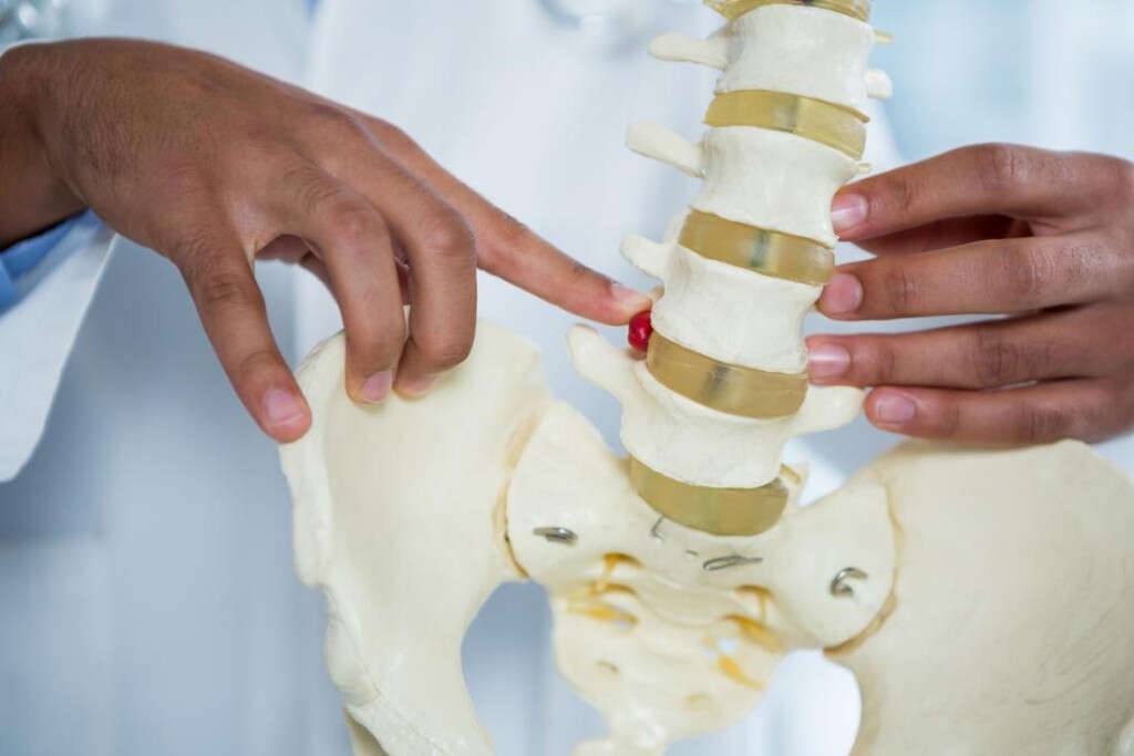 Spondylosis