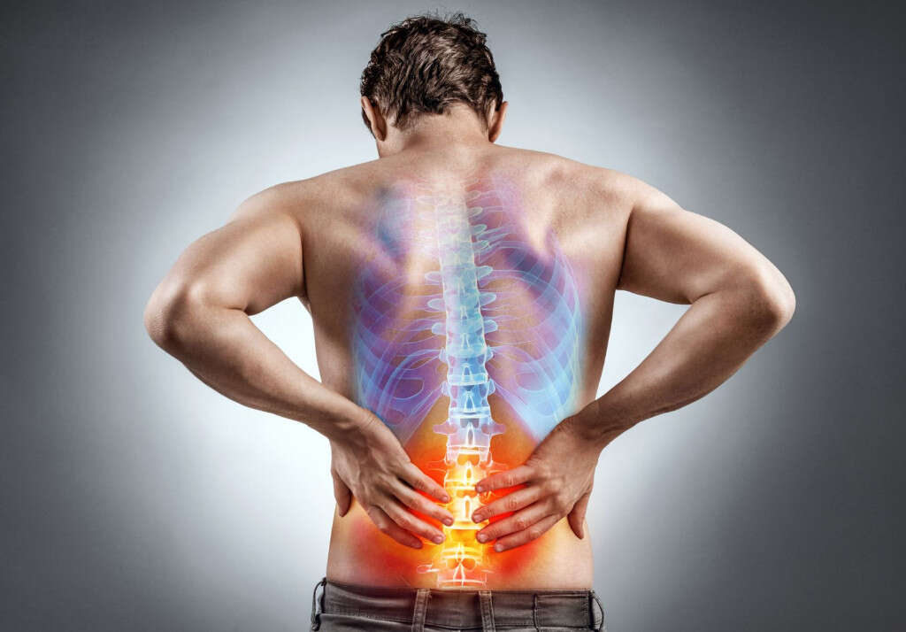 Spondylosis