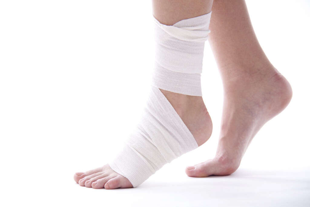 Sprained Ankle