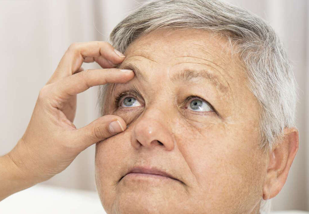 Strabismus