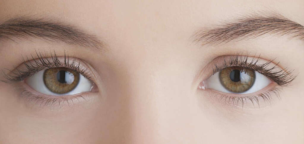Strabismus