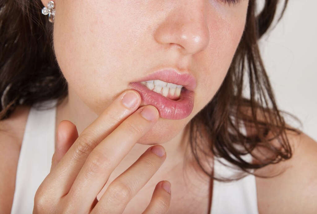 Swollen Uvula