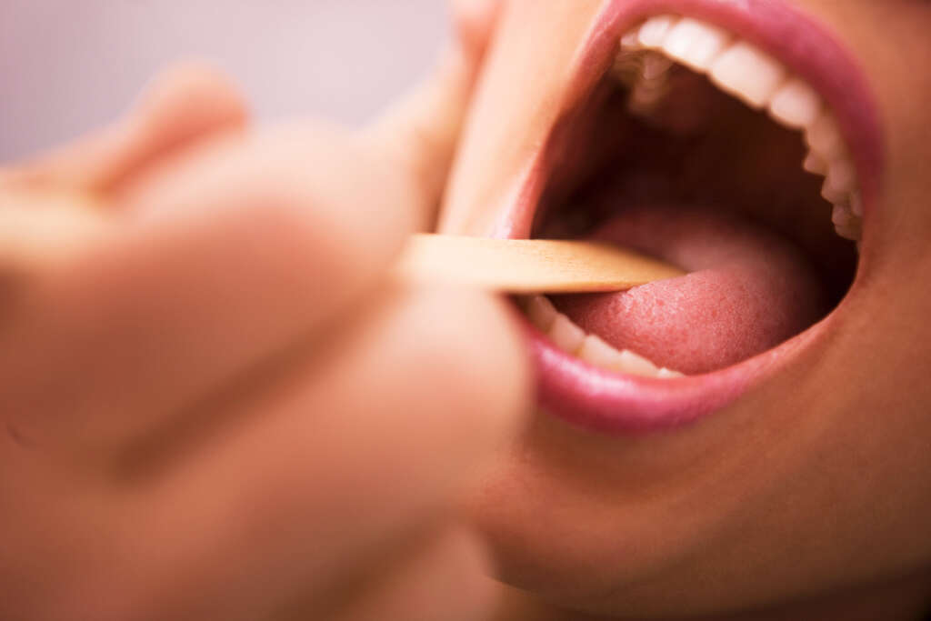Swollen Uvula