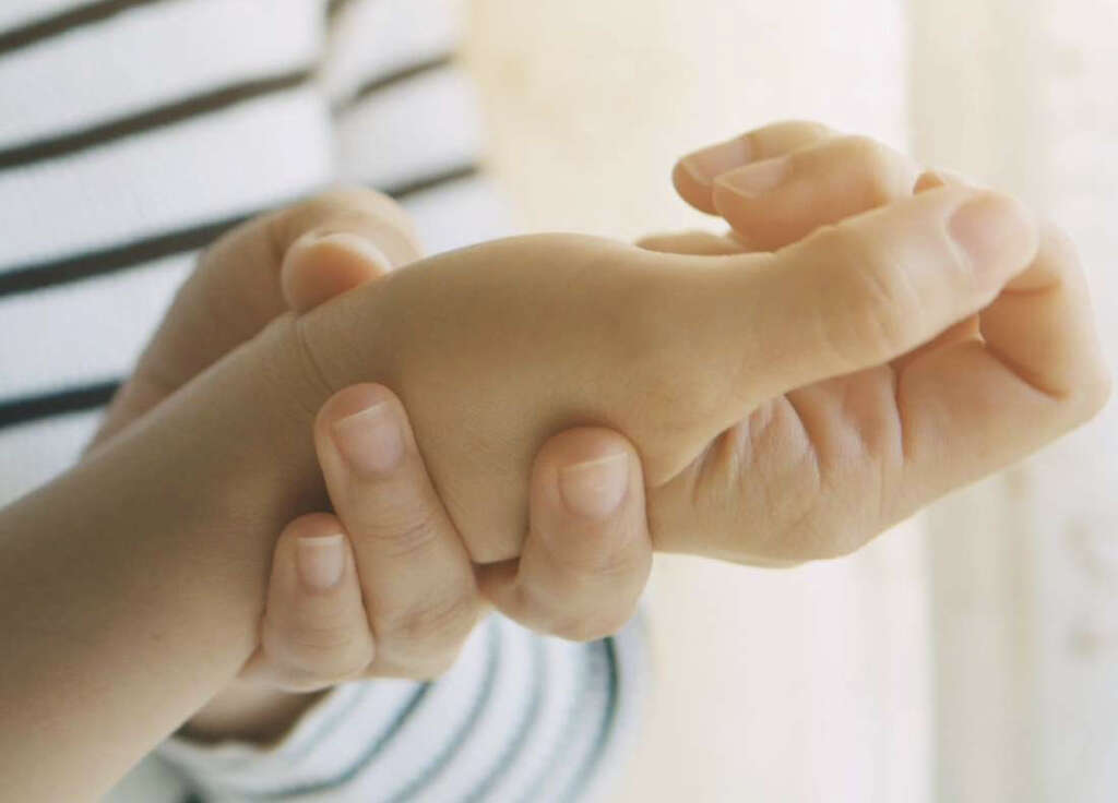 Chilblains