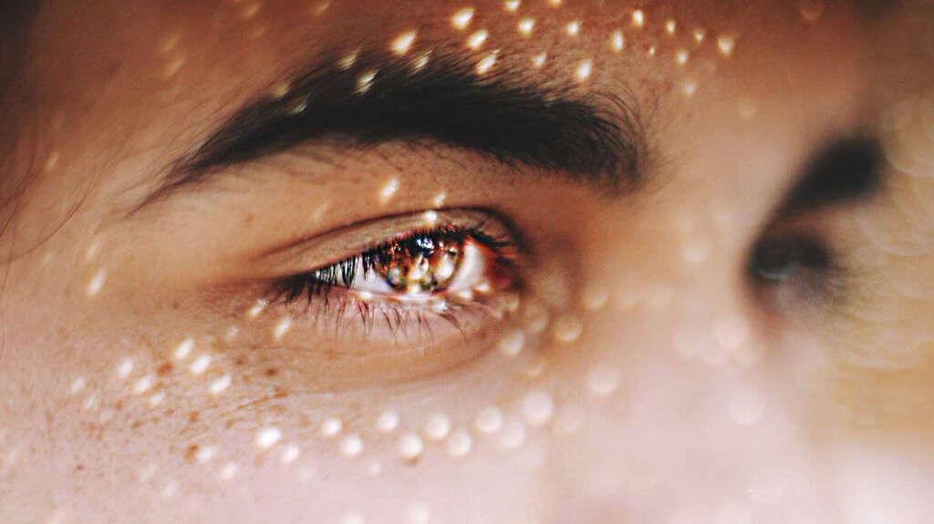 Diabetic Retinopathy