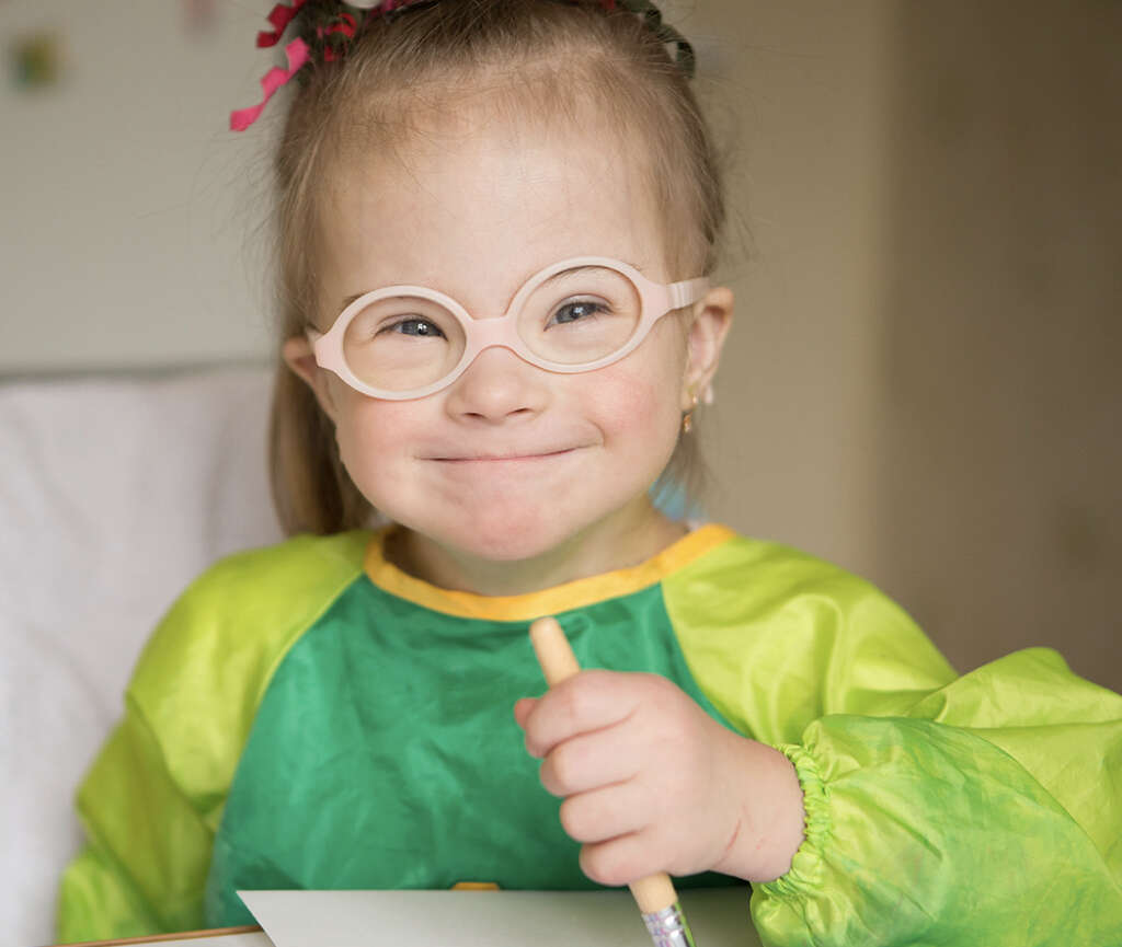 Down Syndrome