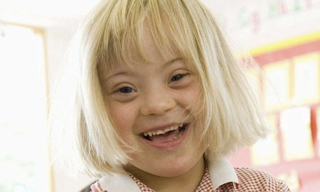 Down Syndrome