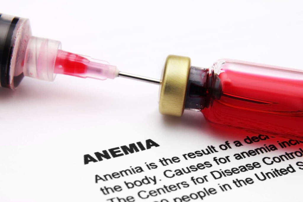 Liver Cancer