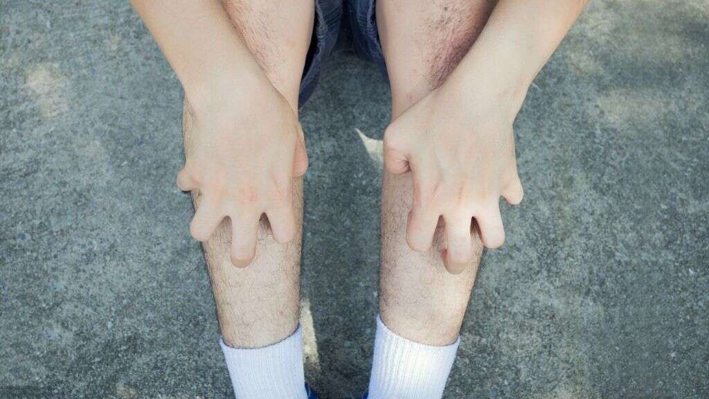 Phlebitis