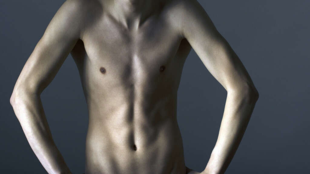 Testicular Cancer
