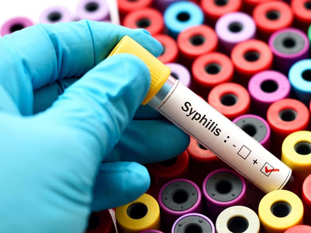 Syphilis