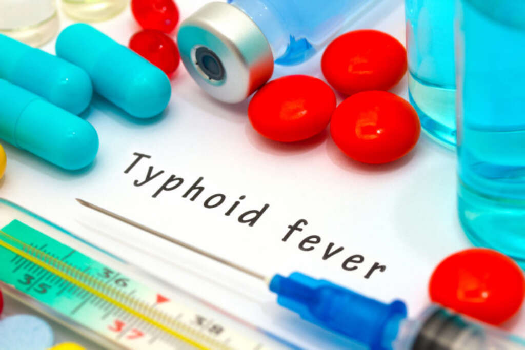 Typhoid Fever