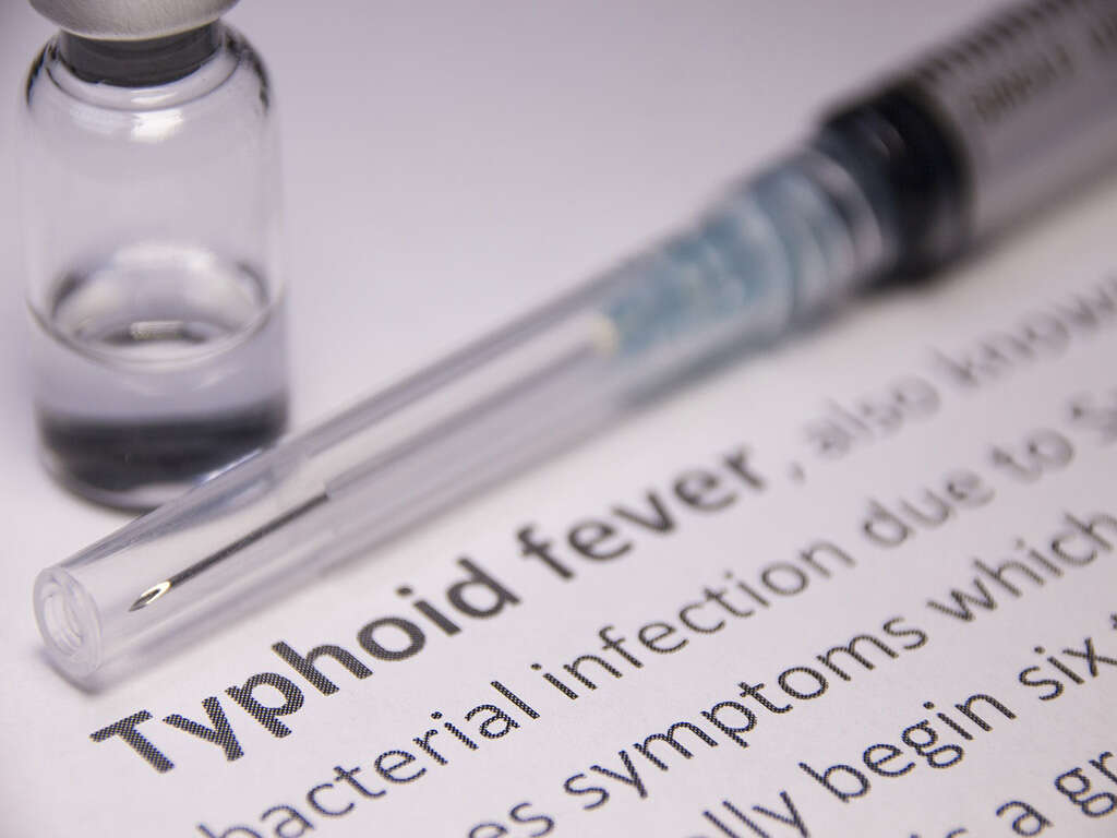 Typhoid Fever