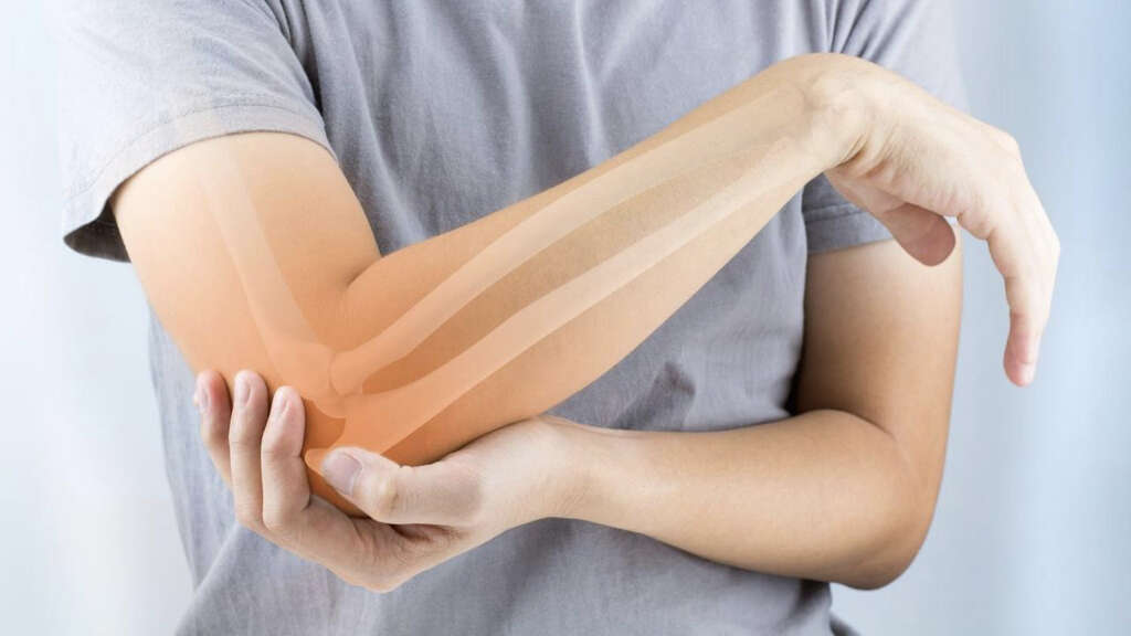 Ulnar Nerve Entrapment