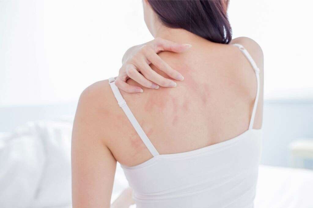 Underactive Thyroid