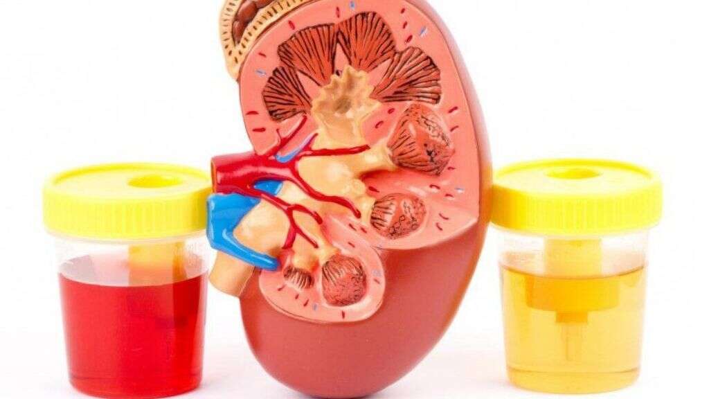 Urethritis