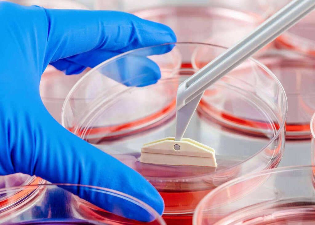 Urinary Tract Infection
