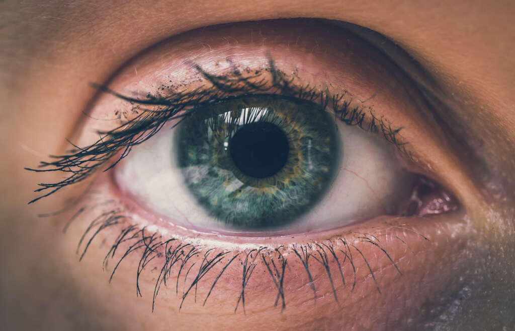Cataracts