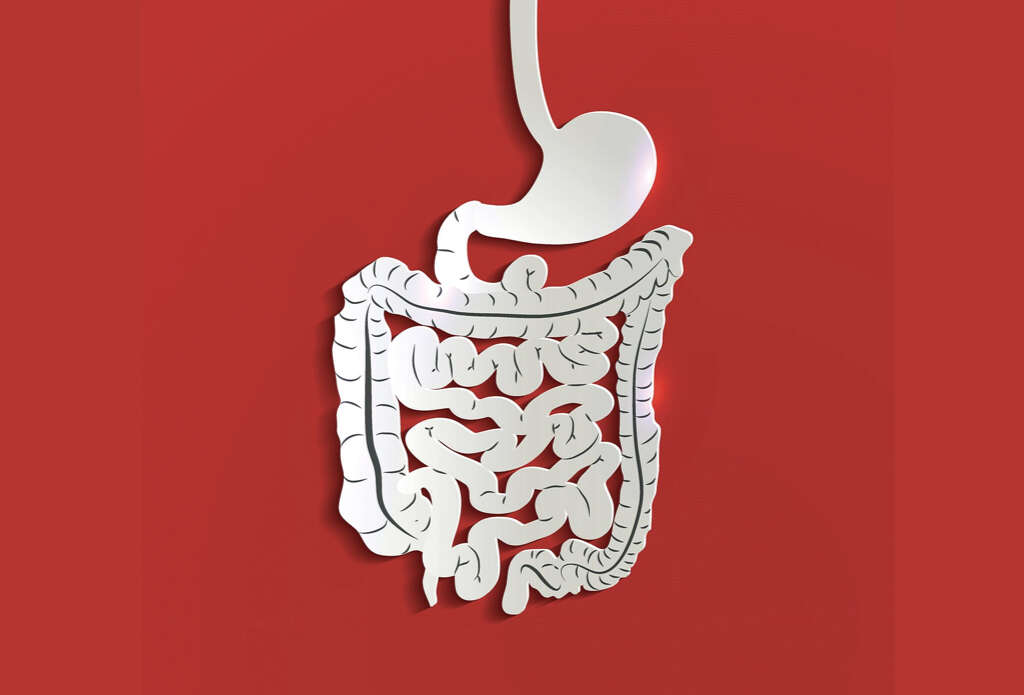 Colon Polyps