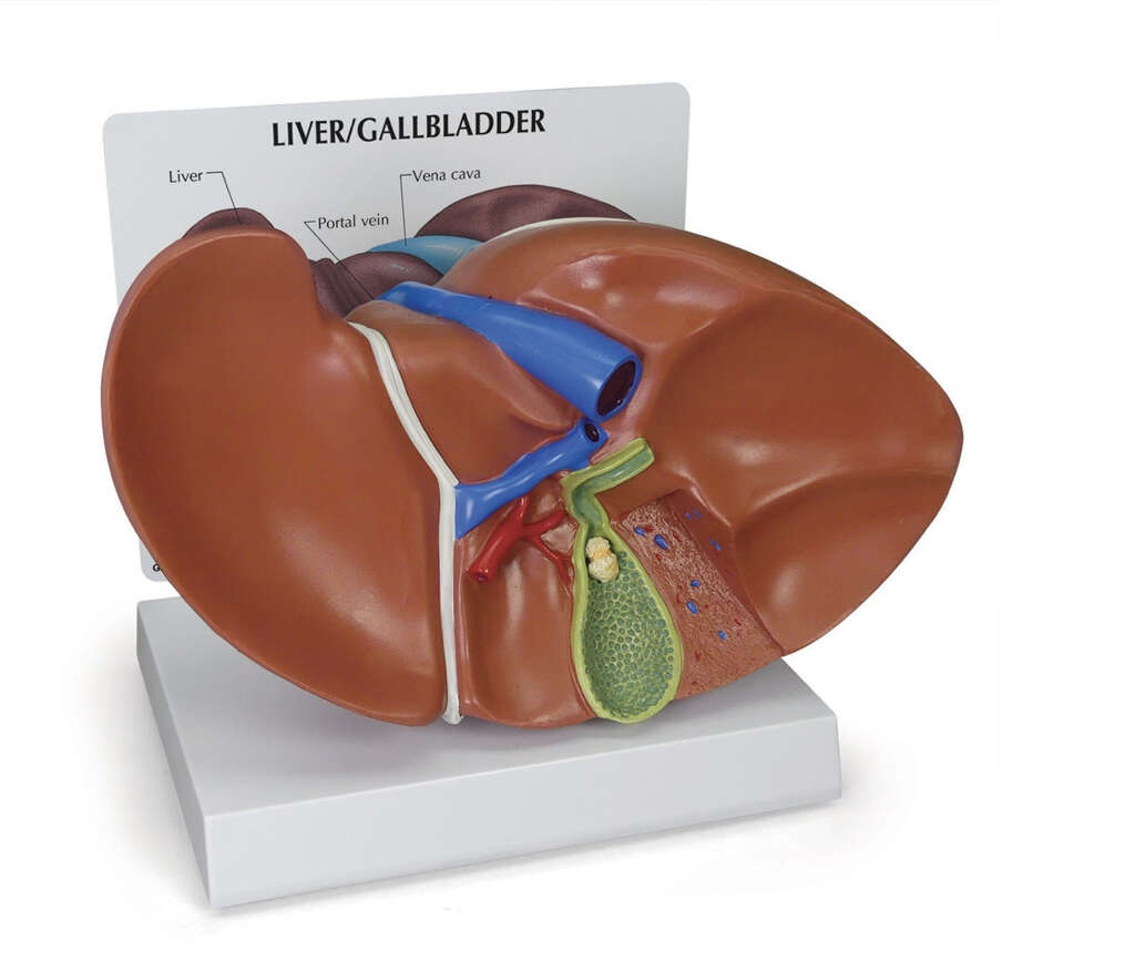 Gallbladder Stones