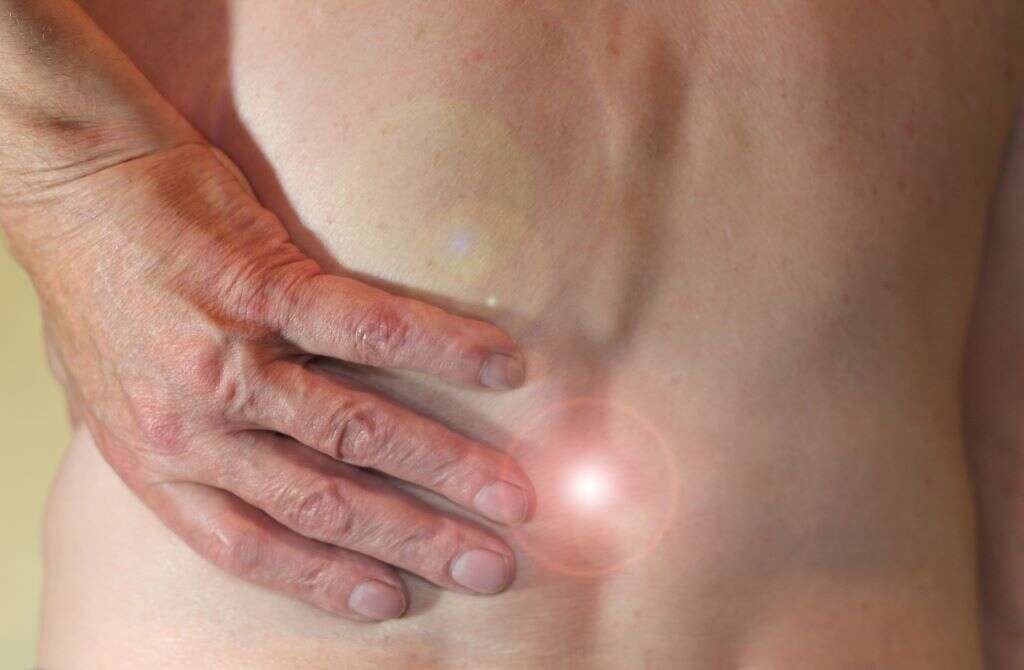 Hemangiomas