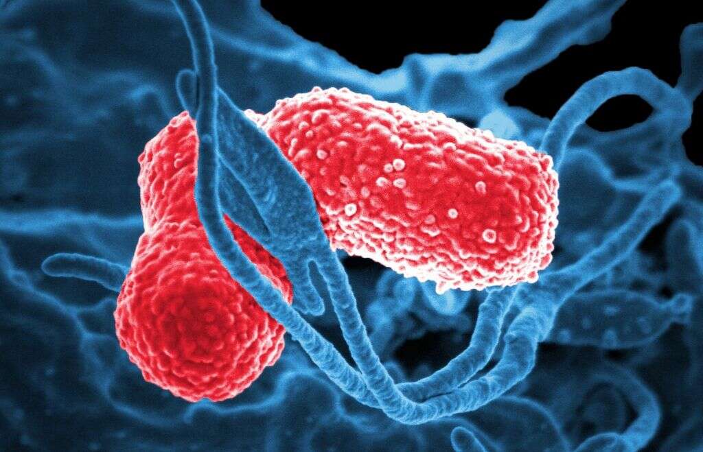 Klebsiella Pneumoniae