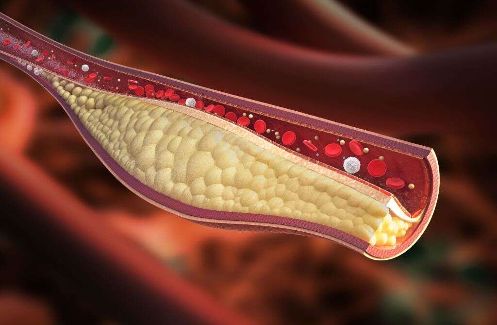 Lipids