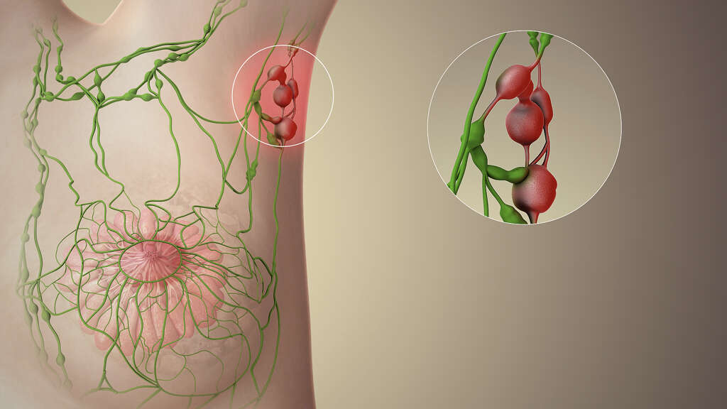 Lymph Nodes