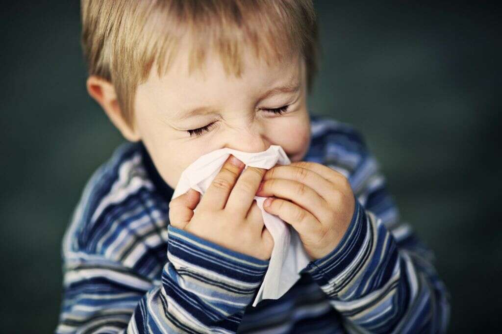 Measles