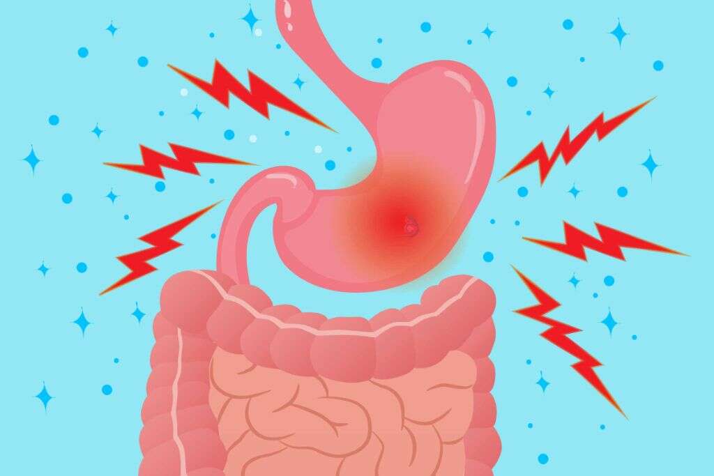 NSAIDS