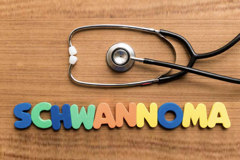 Schwannomas