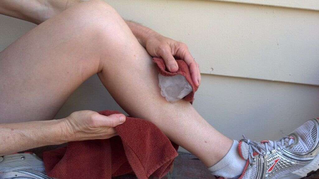 Shin Splints