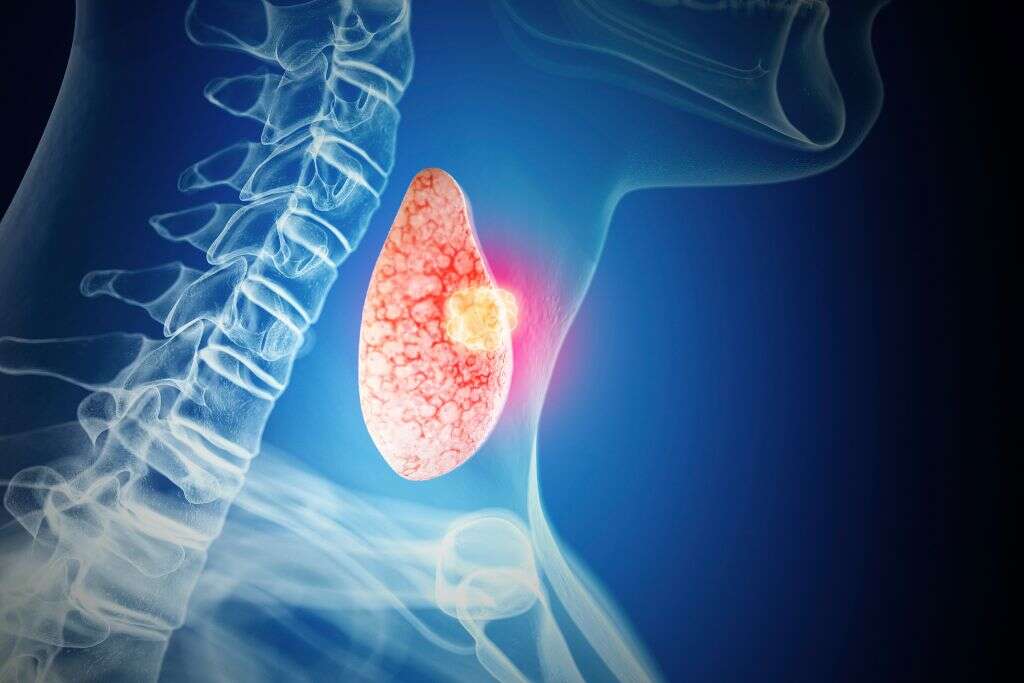 Thyroid