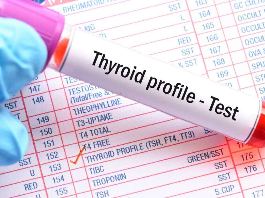 Thyroid