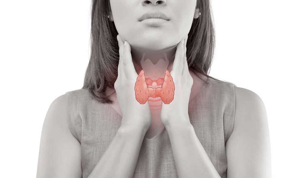 Thyroid Nodules